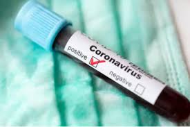 Coronavirus Positive for a student who wrote SSLC Science Exam in Kundapur